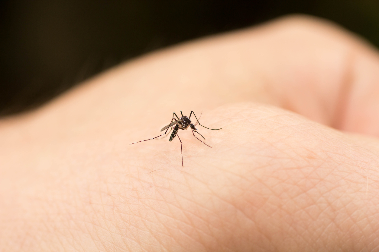 how-to-stop-mosquito-bites-from-itching