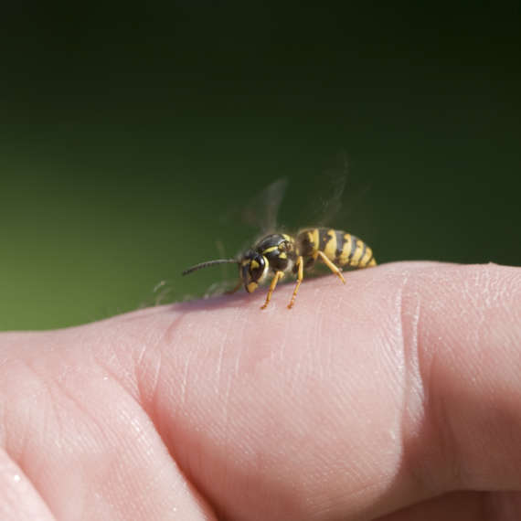 insect stings