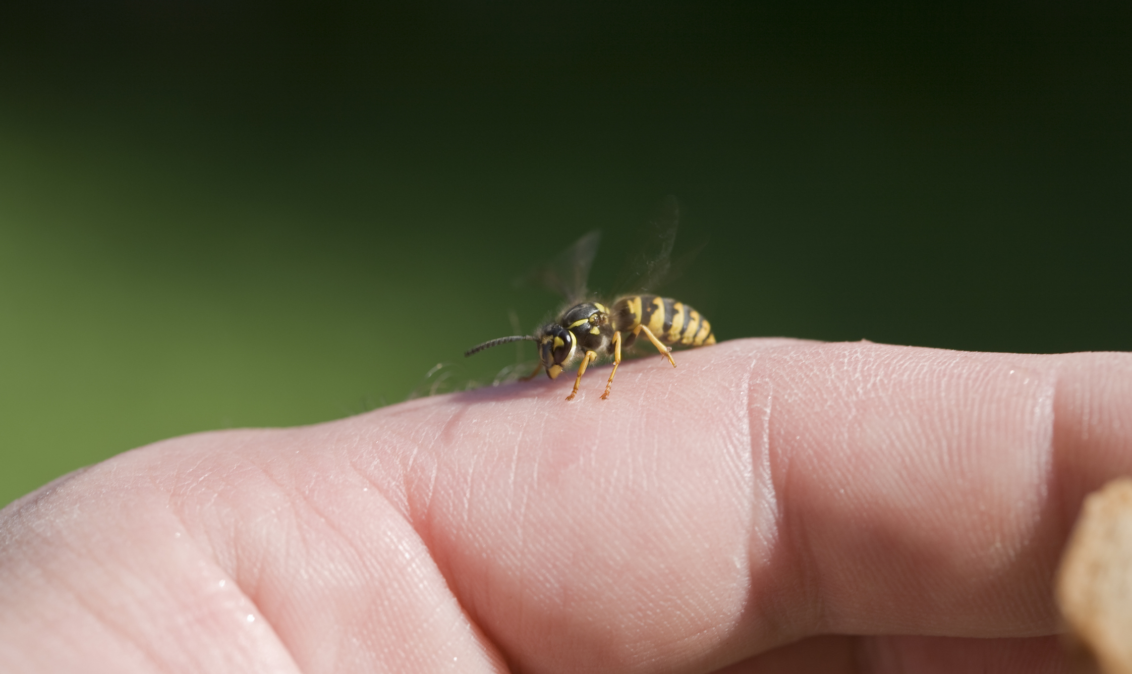 insect stings